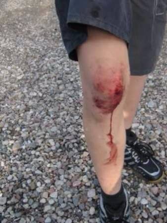 I chociaż czasami bolało